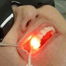 Laser Terapia